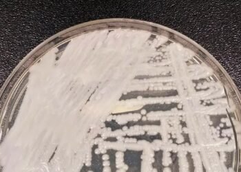 Fungo resistente avança nos hospitais da Europa e preocupa autoridades de saúde