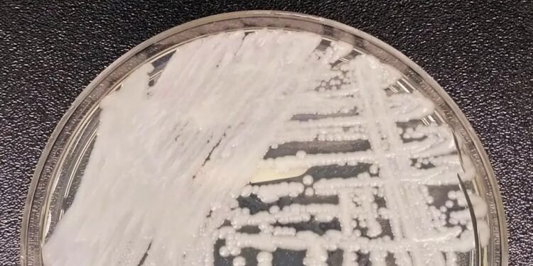 Fungo resistente avança nos hospitais da Europa e preocupa autoridades de saúde