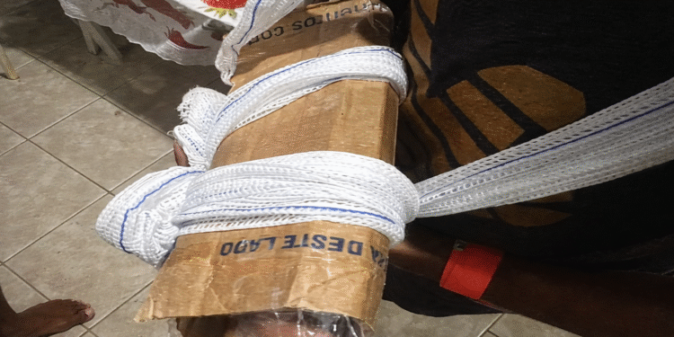 Papelão no lugar de gesso: UPA improvisa atendimento em São Pedro da Aldeira