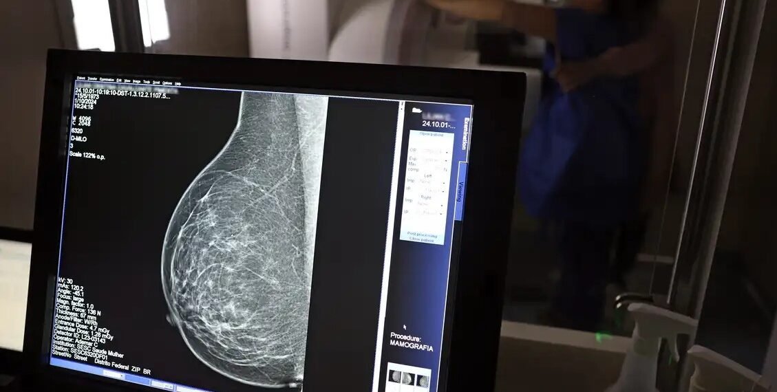 Lei municipal cria prioridade e prazo para mamografia em Búzios