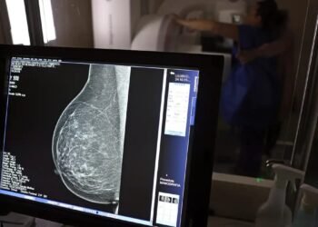 Lei municipal cria prioridade e prazo para mamografia em Búzios