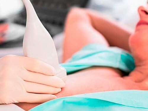 Cabo Frio inicia mutirão de biópsias de exames de mama e tireoide